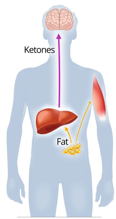 Cétose avec NexaSlim